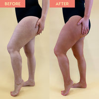 Before and after comparison of a person's legs on a beige background