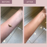 Before and after comparison of an arm. The image demonstrates how HD Wonderglow tans the skin and provides coverage to veins