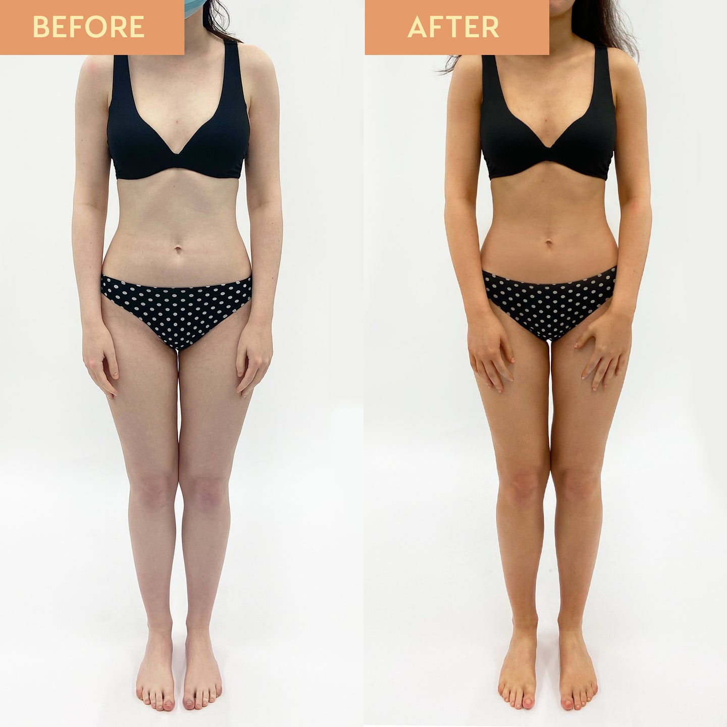 Before and after comparison of a person wearing a black bikini with white polka dots on a white background.