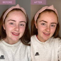 Before and after comparison of a woman following use of the Overnight Hyaluronic Tan Balm