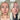 Before and after comparison of a woman's skin demonstrating an improvement in skin breakouts 