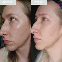 before and after image of a lady who has oily skin before using the product and an improvement of less oil shown on her skin after using the SPF moisturizer