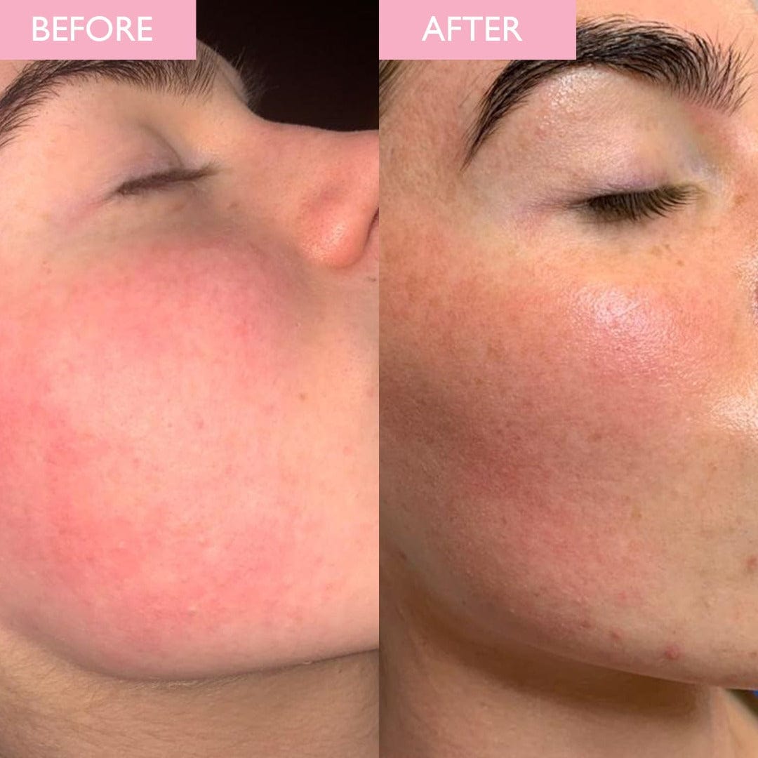 SKINICIAN Revitalising Repair Mask before and after image
